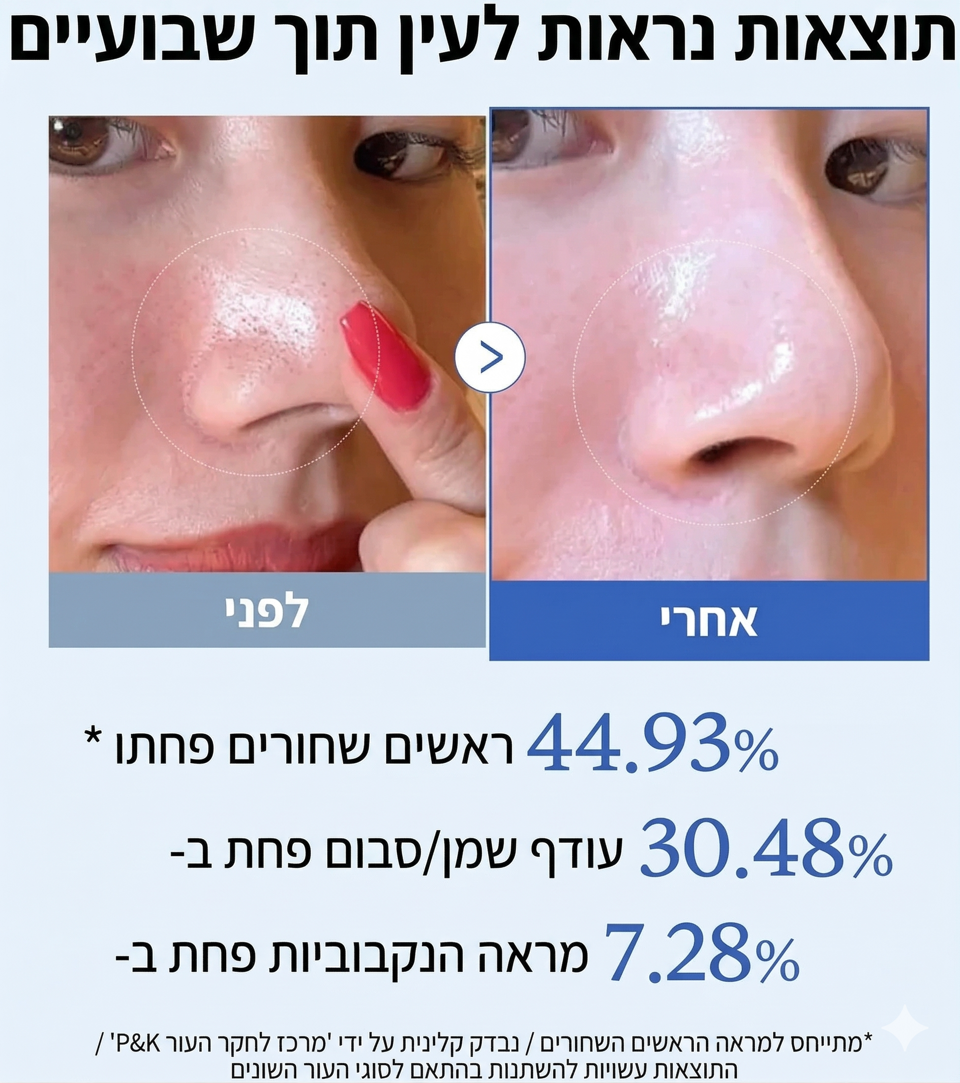 Zero Pore Pad 2.0  רפידות ניקוי נקבוביות mutualdropshopping